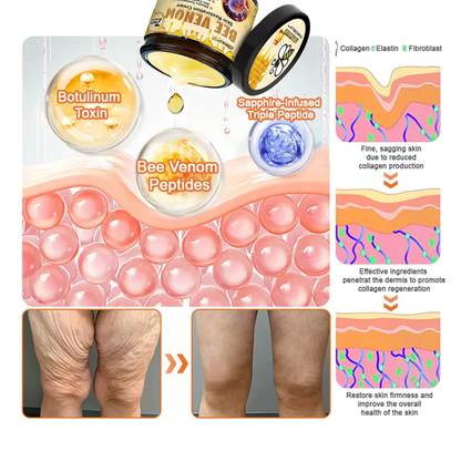 🎁Tiworld™ Bee venom Comprehensive Cream — 🔥Limited Time 80% OFF🔥