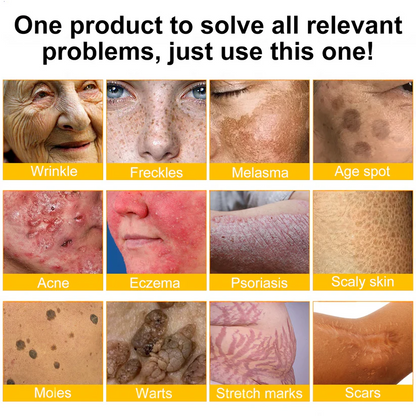 🎁Tiworld™ Bee venom Comprehensive Cream — 🔥Limited Time 80% OFF🔥