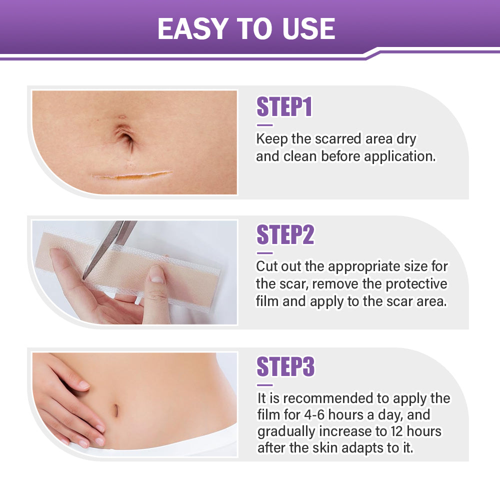 ✅Official Store |SEAGRIL® Hyaluronic Acid Nano Microneedle Repair Tape🏥(Treatment of old and new scars, reduction of surgical scars, stretch marks, keloids, acne, burns, warts, dermatomes and varicose veins)