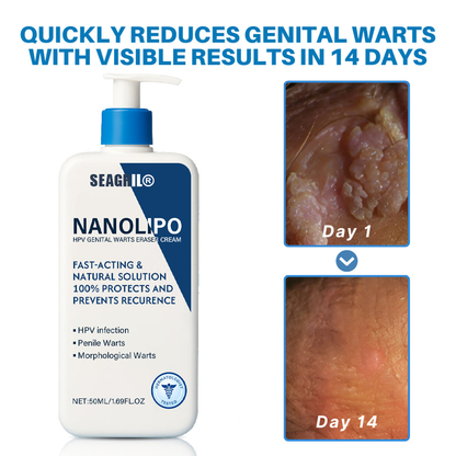 SEAGRIL® NanoLipo HPV Genital Warts Eraser Cream Pro