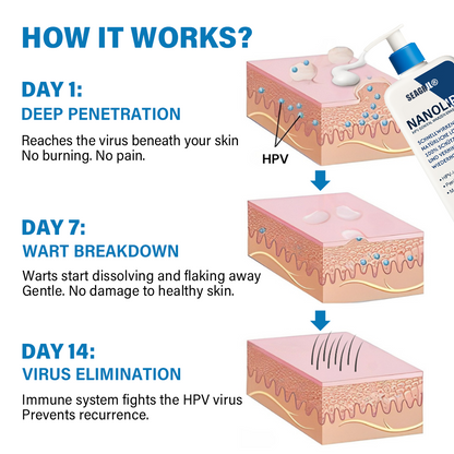 SEAGRIL® NanoLipo HPV Genital Warts Eraser Cream Pro