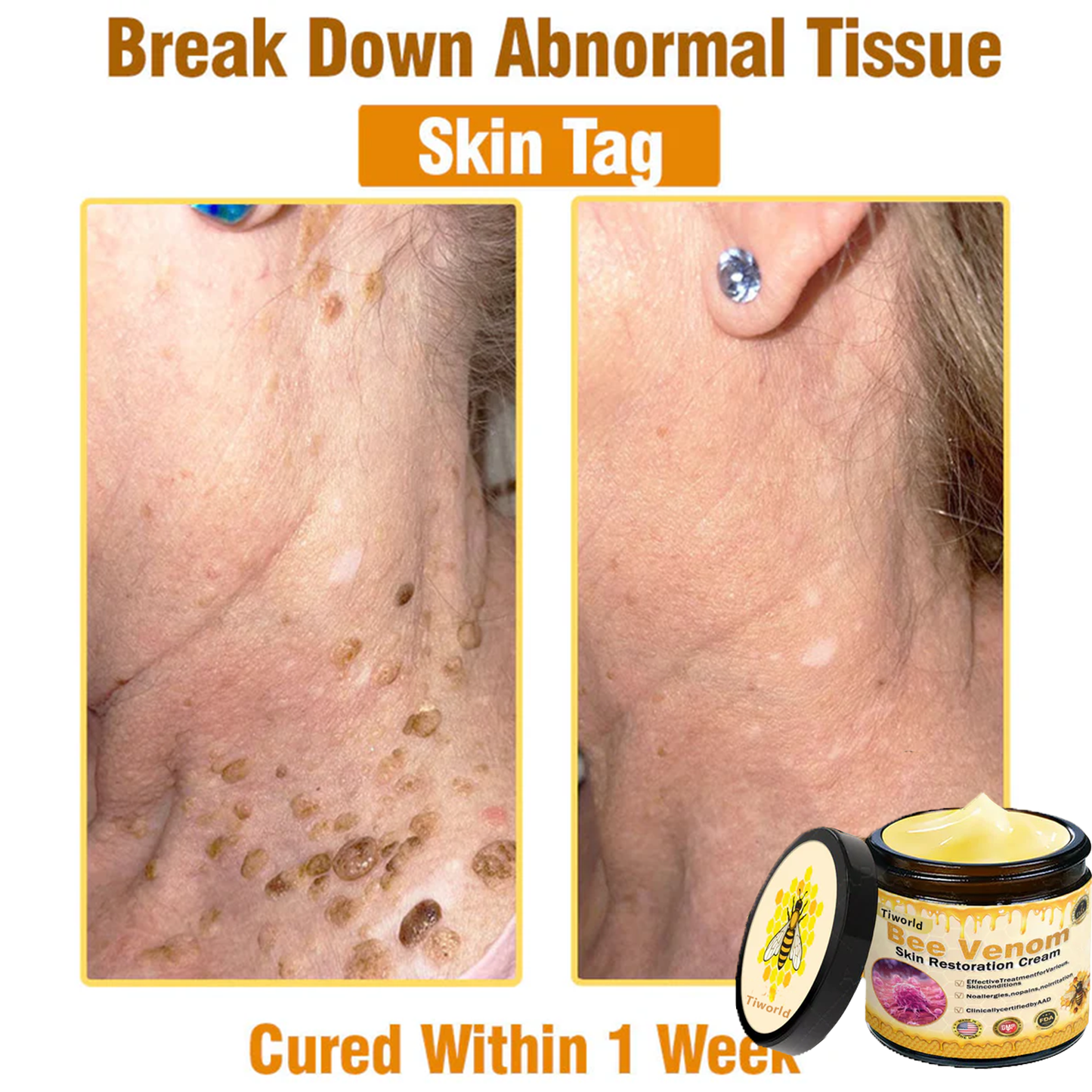 🎁Tiworld™ Bee venom Comprehensive Cream — 🔥Limited Time 80% OFF🔥