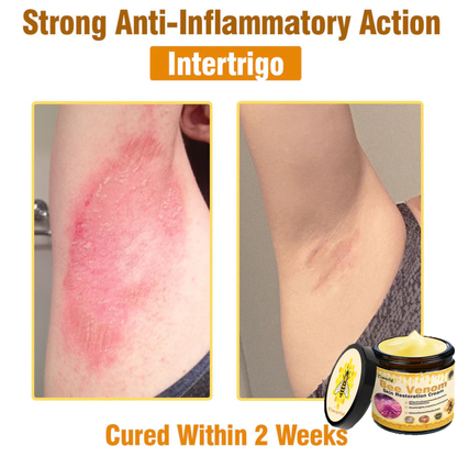 🎁Tiworld™ Bee venom Comprehensive Cream — 🔥Limited Time 80% OFF🔥